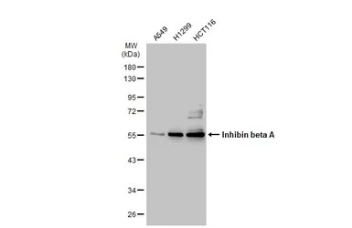 Inhibin beta A antibody