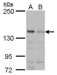 JARID2 antibody
