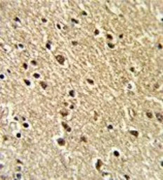 ZFP36 antibody, Internal