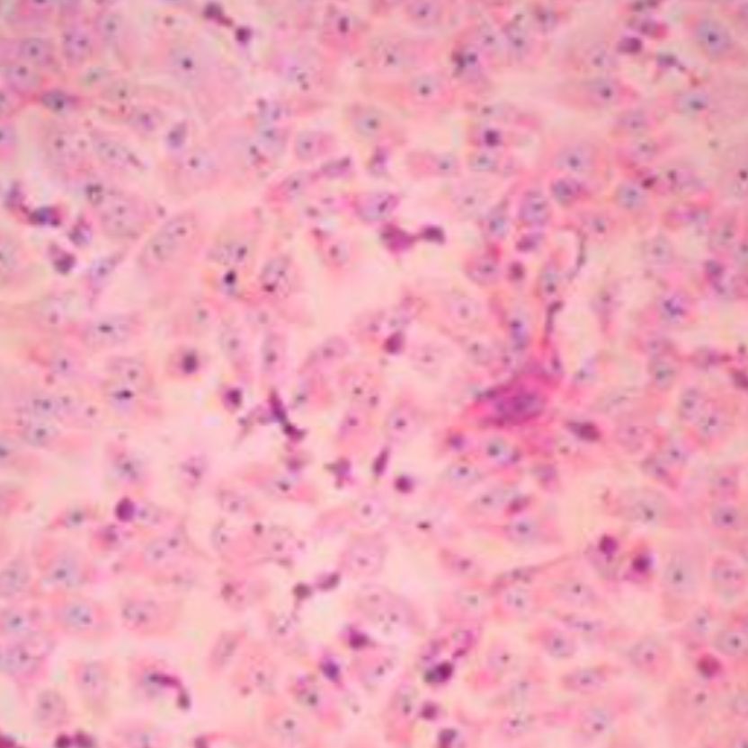 瑞士姬姆萨复合染色