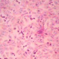 瑞士姬姆萨复合染色