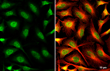 O-GlcNAc transferase antibody