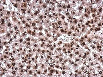 Histone H2AK5ac (acetyl Lys5) 