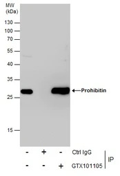 Prohibitin antibody