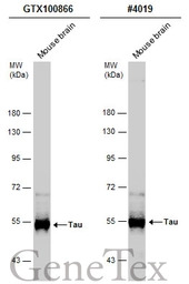 Tau antibody