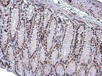 ARID1A antibody [GT3611]