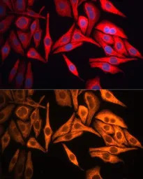 Cytokeratin 8 antibody