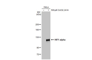 HIF1 alpha antibody [GT10211]