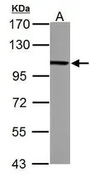 alpha Actinin 4 antibody [N1N2