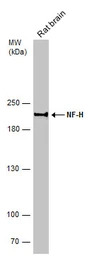 NF-H antibody