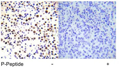 Histone H3T3ph (phospho Thr3) 