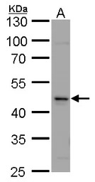 Calsequestrin 2 antibody