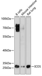 ICOS antibody