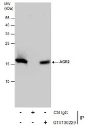 Anterior Gradient 2 antibody