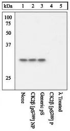 Casein Kinase 2 beta (phospho 