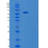 人补体成分C1q受体/C1QR1/CD93重组蛋白
