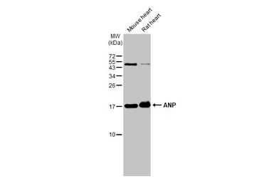 ANP antibody [N1C3]