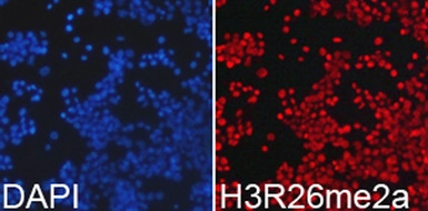 Histone H3R26me2 (Asymmetric D