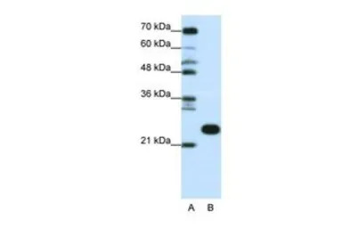 RPL13 antibody, C-term