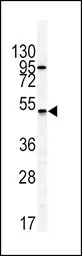 GIPR antibody, N-term