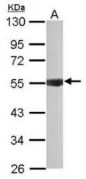 IPPK antibody [N2C2], Internal