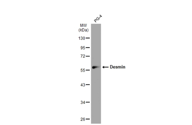 Desmin antibody