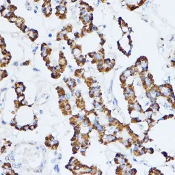 Monoamine Oxidase A antibody