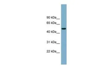 PRSS16 antibody, Internal