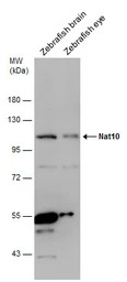 NAT10 antibody