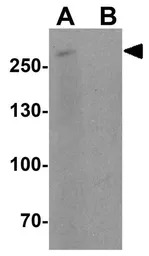 Cav3.2 antibody