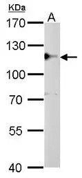 CYLD antibody