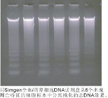 全血／培养细胞DNA试剂盒