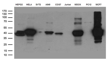 Cytokeratin 8 antibody [4D12]