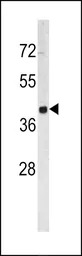 TACSTD2 antibody, Internal