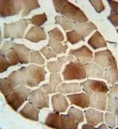 Factor B (Bb fragment) antibod