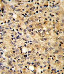 COMP antibody, Internal