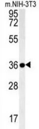 Galectin 9B antibody