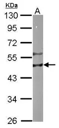 RIPX antibody [N1C1]