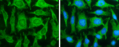 Fatty Acid Synthase antibody [