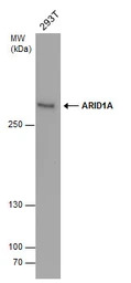 ARID1A antibody [GT3611]
