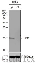 PBR antibody