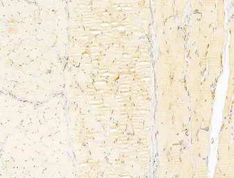 AMPK alpha 1 (phospho Thr183) 