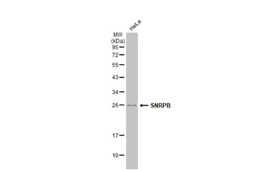 SNRPB antibody