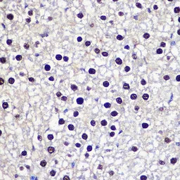Transketolase antibody