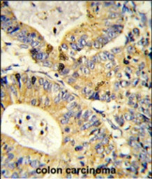 RPS18 antibody, Internal