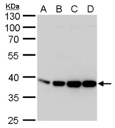Aldolase A antibody