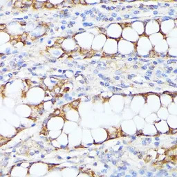 SMYD4 antibody