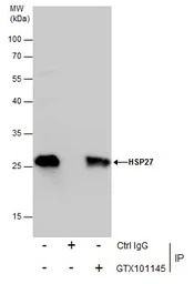 HSP27 antibody