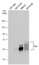 Tau antibody