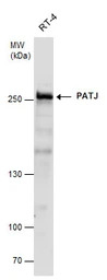 PATJ antibody [N1N2], N-term